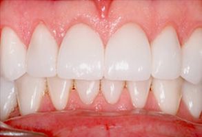 Dental Photos 06475