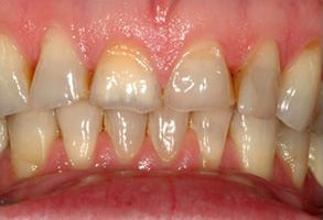 06475 Dental Photos